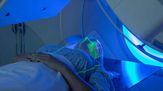 New Radiotherapy Technique for Treating Head and Neck Cancer Could Reduce Treatment Times by Nearly Half